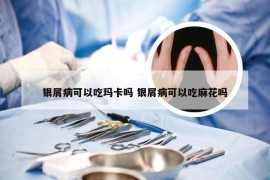 银屑病可以吃玛卡吗 银屑病可以吃麻花吗