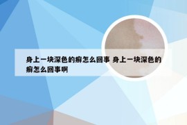 身上一块深色的癣怎么回事 身上一块深色的癣怎么回事啊