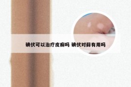 碘伏可以治疗皮癣吗 碘伏对藓有用吗