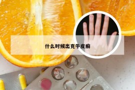 什么时候出克牛皮癣