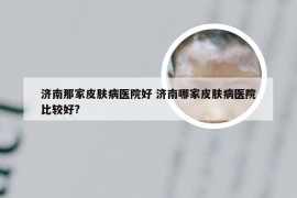 济南那家皮肤病医院好 济南哪家皮肤病医院比较好?