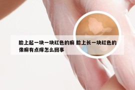 脸上起一块一块红色的癣 脸上长一块红色的像癣有点痒怎么回事