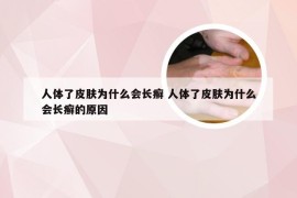 人体了皮肤为什么会长癣 人体了皮肤为什么会长癣的原因