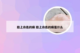 脸上白色的癣 脸上白色的癣是什么