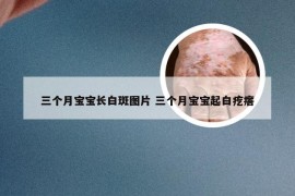 三个月宝宝长白斑图片 三个月宝宝起白疙瘩