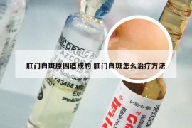 肛门白斑原因造成的 肛门白斑怎么治疗方法