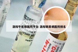 洛阳牛皮癣医院平台 洛阳银屑病医院排名