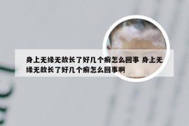 身上无缘无故长了好几个癣怎么回事 身上无缘无故长了好几个癣怎么回事啊