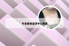 牛皮癣来迎泽中心银屑