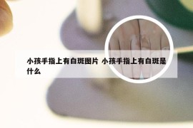 小孩手指上有白斑图片 小孩手指上有白斑是什么