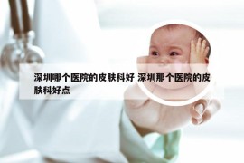 深圳哪个医院的皮肤科好 深圳那个医院的皮肤科好点