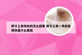 脖子上有块白的怎么回事 脖子上有一块白色斑块是什么原因