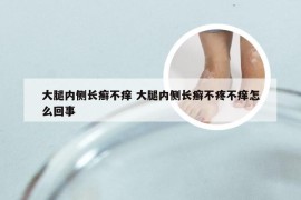 大腿内侧长癣不痒 大腿内侧长癣不疼不痒怎么回事