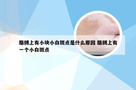 胳膊上有小块小白斑点是什么原因 胳膊上有一个小白斑点