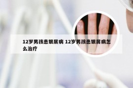 12岁男孩患银屑病 12岁男孩患银屑病怎么治疗