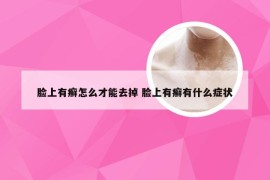 脸上有癣怎么才能去掉 脸上有癣有什么症状