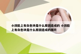 小孩脸上有白色块是什么原因造成的 小孩脸上有白色块是什么原因造成的图片