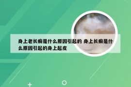 身上老长癣是什么原因引起的 身上长癣是什么原因引起的身上起皮