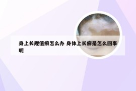 身上长规值癣怎么办 身体上长癣是怎么回事呢