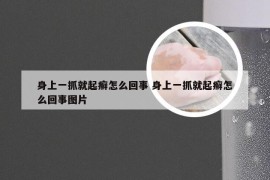 身上一抓就起癣怎么回事 身上一抓就起癣怎么回事图片