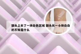 额头上长了一块白色区域 额头长一小块白白的不知是什么