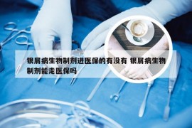 银屑病生物制剂进医保的有没有 银屑病生物制剂能走医保吗