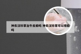 神农汉珍草治牛皮癣吗 神农汉珍草可以擦脸吗