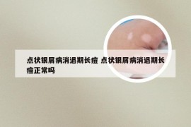 点状银屑病消退期长痘 点状银屑病消退期长痘正常吗