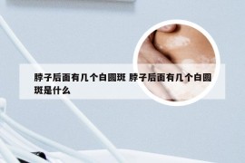 脖子后面有几个白圆斑 脖子后面有几个白圆斑是什么