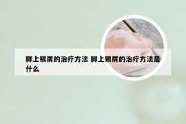 脚上银屑的治疗方法 脚上银屑的治疗方法是什么