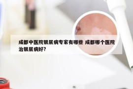 成都中医院银屑病专家有哪些 成都哪个医院治银屑病好?