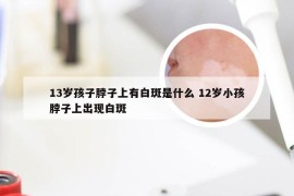 13岁孩子脖子上有白斑是什么 12岁小孩脖子上出现白斑