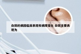 白斑的病因临床表现和病理变化 白斑主要表现为