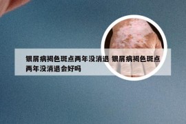 银屑病褐色斑点两年没消退 银屑病褐色斑点两年没消退会好吗