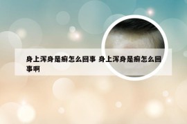 身上浑身是癣怎么回事 身上浑身是癣怎么回事啊