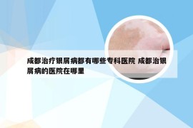 成都治疗银屑病都有哪些专科医院 成都治银屑病的医院在哪里