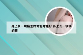 身上长一块癣怎样才能才能好 身上长一块块的藓