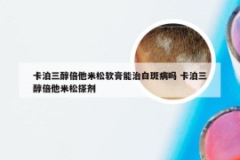 卡泊三醇倍他米松软膏能治白斑病吗 卡泊三醇倍他米松搽剂