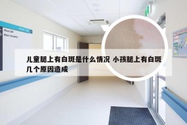 儿童腿上有白斑是什么情况 小孩腿上有白斑几个原因造成