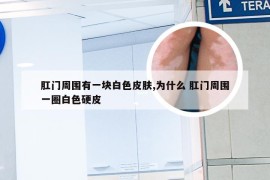 肛门周围有一块白色皮肤,为什么 肛门周围一圈白色硬皮