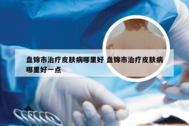 盘锦市治疗皮肤病哪里好 盘锦市治疗皮肤病哪里好一点