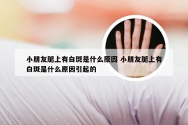 小朋友腿上有白斑是什么原因 小朋友腿上有白斑是什么原因引起的