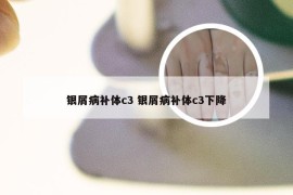 银屑病补体c3 银屑病补体c3下降