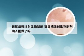 银屑病哪注射生物制剂 银屑病注射生物制剂纳入医保了吗