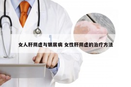 女人肝阴虚与银屑病 女性肝阴虚的治疗方法