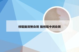 核磁脑双侧白斑 脑核磁中间白斑