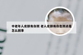 中老年人皮肤有白斑 老人皮肤有白色斑点是怎么回事