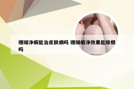 珊瑚净癣能治皮肤病吗 珊瑚癣净效果能除根吗