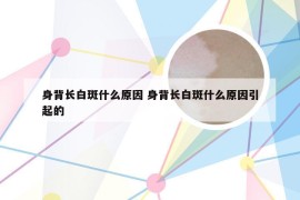 身背长白斑什么原因 身背长白斑什么原因引起的