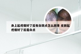 身上起疙瘩好了后有白斑点怎么回事 皮肤起疙瘩好了后是白点